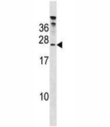 HIV Tat Specific Factor 1 Antibody (HTATSF1)