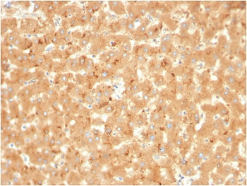 IHC staining of FFPE human liver with A2M antibody. HIER: boil tissue sections in pH 9 10mM Tris wit