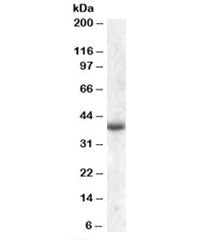 APOL6 Antibody