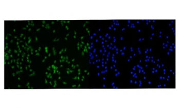 PRMT3 Antibody