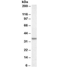 Calretinin Antibody