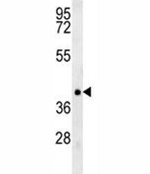 TRAF1 Antibody