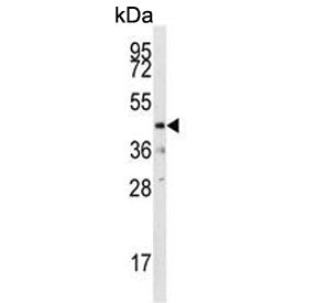 DUSP10 Antibody