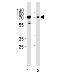 Western blot analysis of lysate from human 1) HeLa, and 2) Jurkat cell line using PAK3 antibody at 1