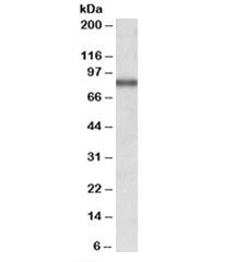 Western blot testing of MCF7 lysate with ALDH18A1 antibody at 1ug/ml. Predicted/observed molecular w