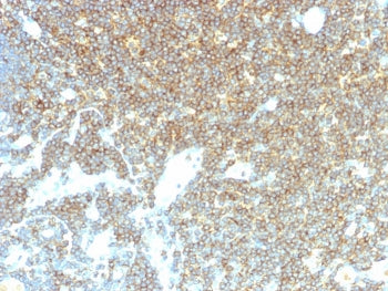 CD48 Antibody (Pan Leukocyte Marker)