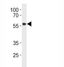 p53 Antibody / TP53, 0.08ml