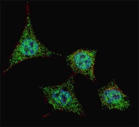 Bad Antibody (phospho-S99)