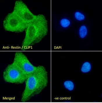 Immunofluorescent staining of fixed and permeabilized human A549 cells with CLIP antibody (green) at