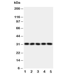 Western blot testing of LOX-1 antibody and Lane 1: HeLa; 2: SMMC-7721; 3: U87; 4: U937; 5: K562 lysa