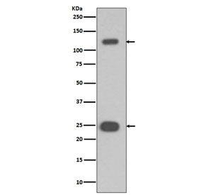 PARP1 Antibody