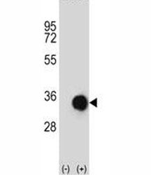 Caspase-6 Antibody