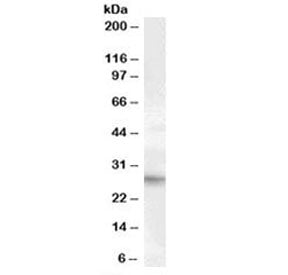 PRRX1 Antibody
