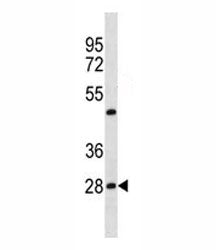 Prohibitin Antibody (PHB1)