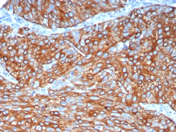 Keratin 6A Antibody / Cytokeratin 6A