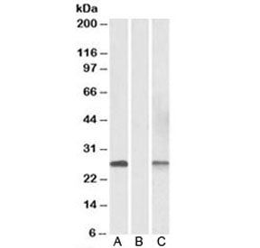 DYDC1 Antibody
