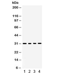 Western blot testing of 1) rat kidney, 2) rat spleen, 3) mouse spleen and 4) human placenta lysate w
