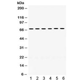 Western blot testing of 1) rat liver, 2) rat lung, 3) mouse liver, 4) mouse lung, 5) human COLO320 a