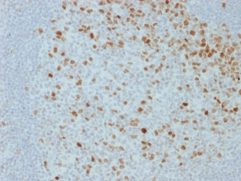 IHC staining of FFPE human lymph node with Proliferation Marker antibody (clone JC1). HIER: boil tis