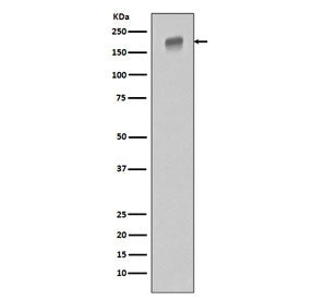 EGFR Antibody