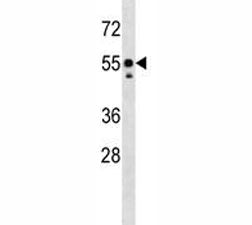 Src antibody western blot analysis in mouse liver tissue lysate.