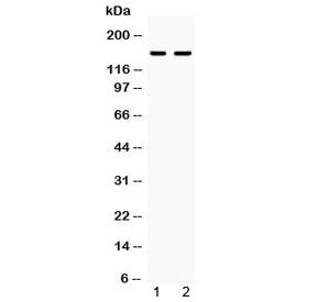 Western blot testing of human 1) Jurkat and 2) CCRF-CEM cell lysate with CD11a antibody at 0.5ug/ml.
