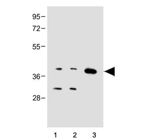 Western blot testing of 1) human Jurkat, 2) human HepG2 and 3) mouse brain tissue lysate with Cx40 a