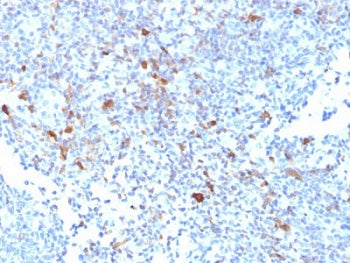 IHC testing of FFPE human lymph node with TRAF1 antibody. HIER: boil tissue sections in pH6, 10mM ci
