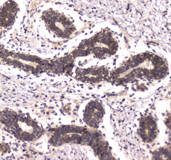 POLR2A Antibody / RPB1