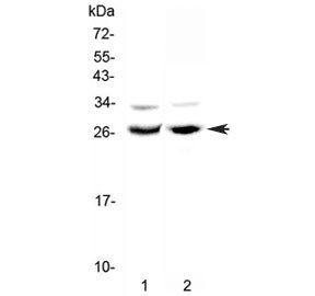 MAD Antibody / MXD1 / Max dimerization protein 1