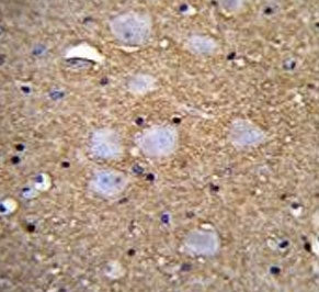CAMSAP1 Antibody