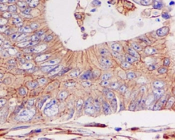 E-Cadherin Antibody / CDH1
