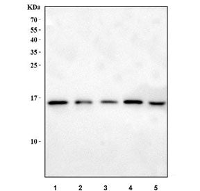 Western blot testing of 1) rat liver, 2) rat NRK, 3) mouse ovary, 4) mouse stomach and 5) mouse live