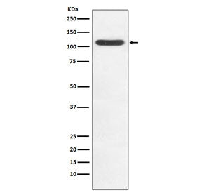 HIP1 Antibody / Huntingtin-interacting protein 1