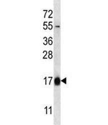 HBQ1 Antibody