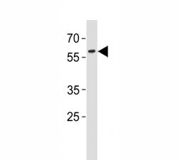 PAX3 Antibody