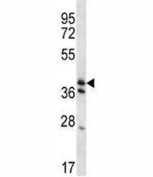 KLF2 Antibody