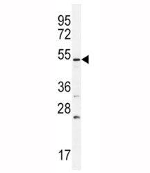 BMPR1B Antibody