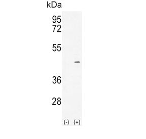 Alcohol dehydrogenase 4 Antibody / ADH4