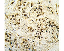 CDC2 Antibody