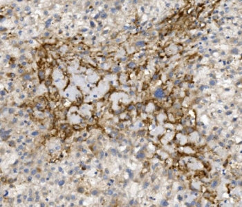 CCR2 Antibody