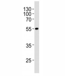 PDX1 Antibody