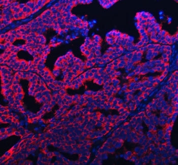 PABPC4 Antibody / Polyadenylate-binding protein 4 / APP-1