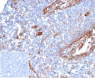 IHC staining of FFPE human tonsil tissue with ICAM1 antibody (clone ICAM1/6319) at 2ug/ml. Negative 