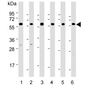HSP60 Antibody
