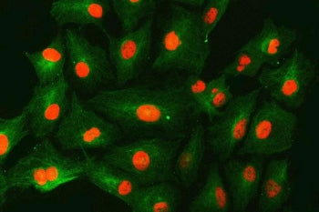 Immunofluorescent staining of FFPE human A549 cells with SNF2H antibody (red) and Beta Tubulin mAb (