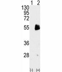 PRMT7 Antibody