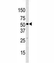 JMJD2D Antibody (KDM4D)