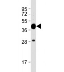 MBP tag Antibody