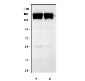 Western blot testing of mouse 1) ANA-1 and 2) RAW264.7 cell lysate with Integrin alpha M antibody. E